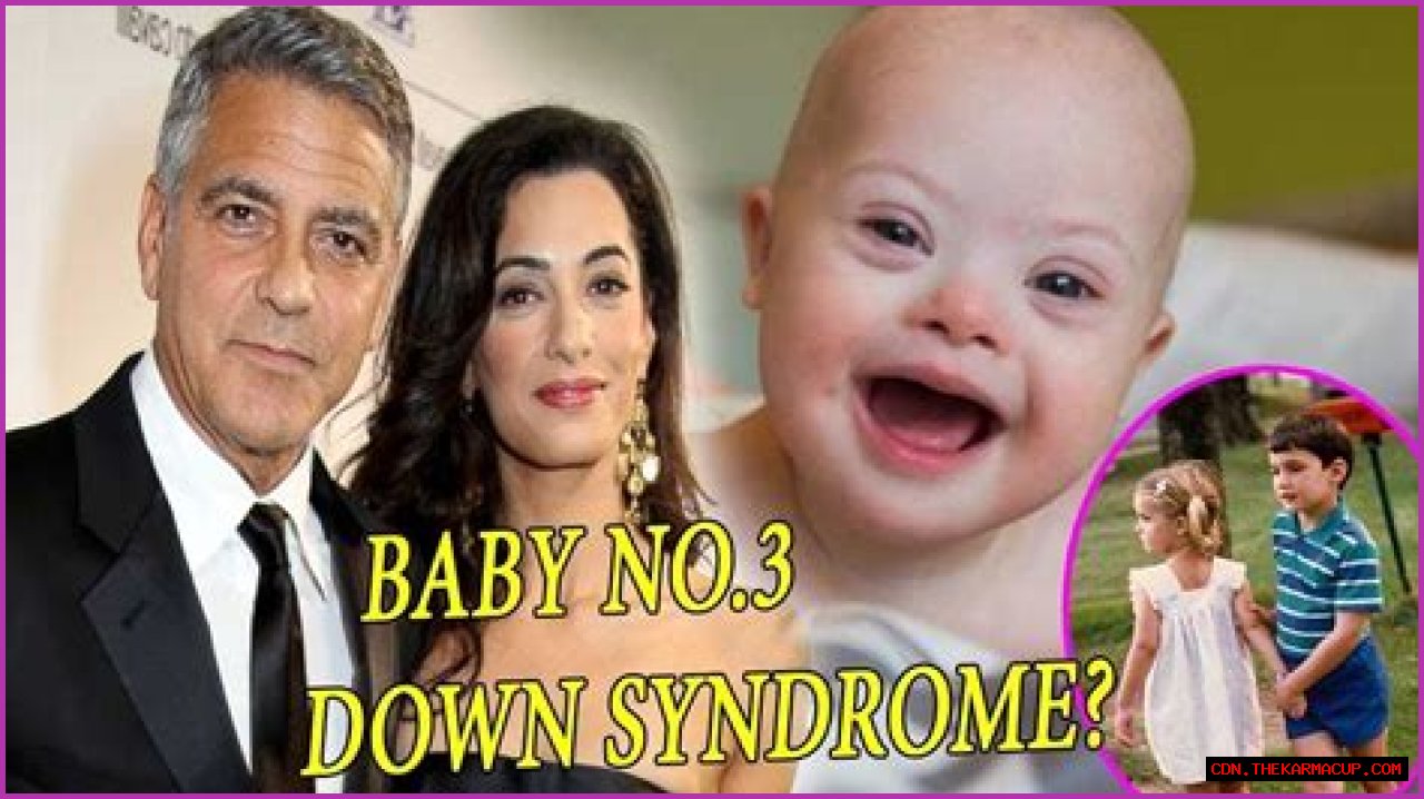 George Clooney's Son: Navigating Life With Down Syndrome