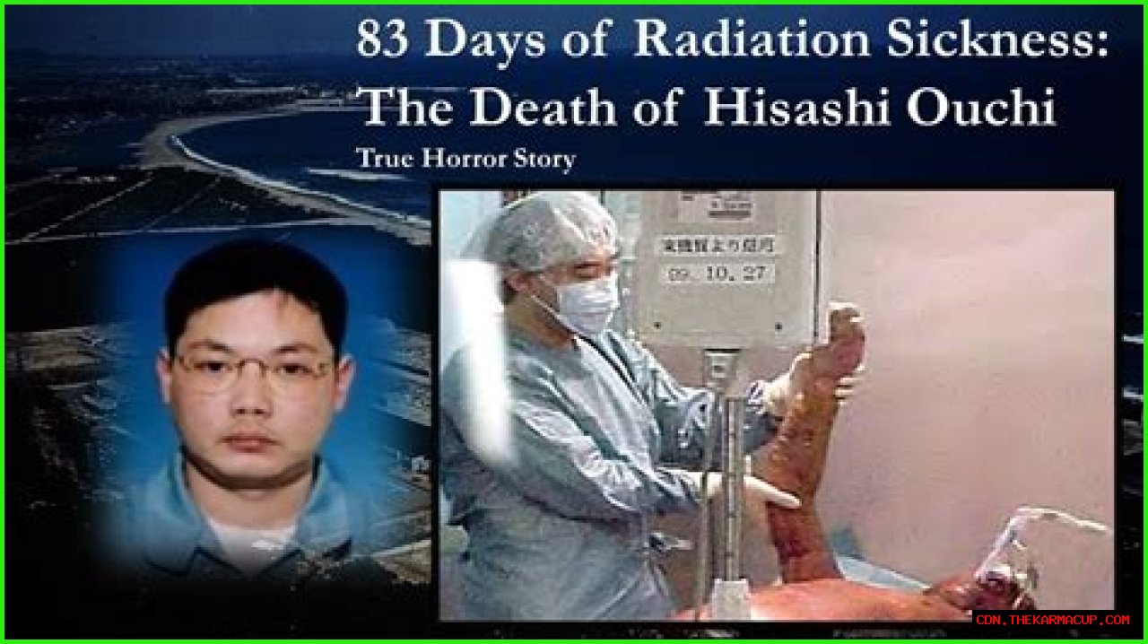 Unveiling The Tragic Story Behind Hisashi Ouchi Hospital Photos